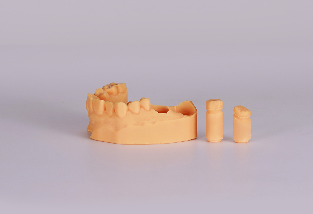 3D printed orthodontic working models case image pending approval