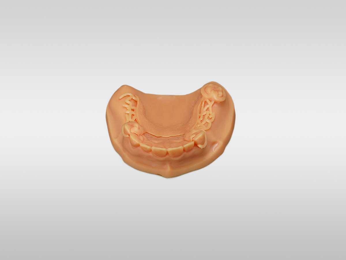 Dental resin 3D printer with model resin and UV curing equipment for orthodontic model production