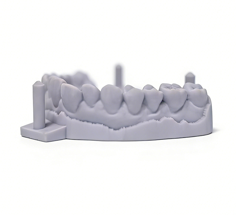 Full arch dental model printed with grey model resin
