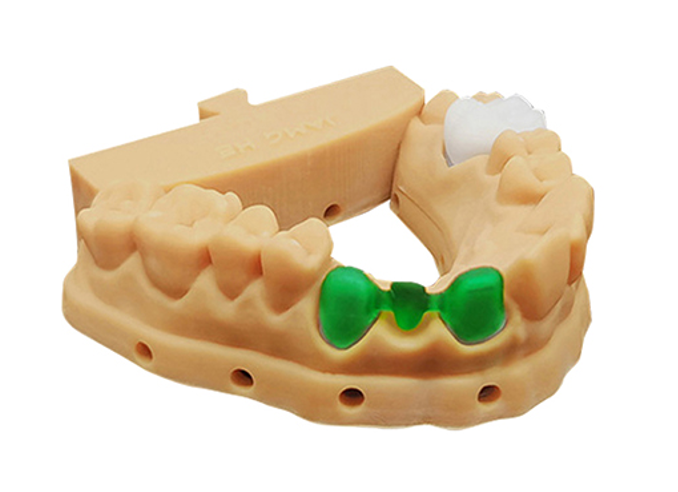 Resin dental model with removable die structures
