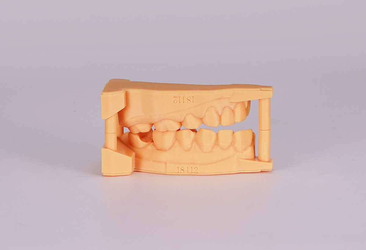 Upper and lower dental study models produced by resin 3D printing